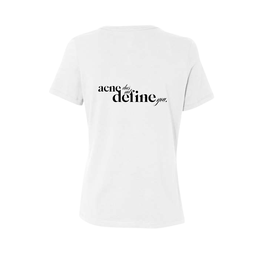 Acne Does Not Define You T-Shirt