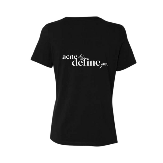 Acne Does Not Define You T-Shirt