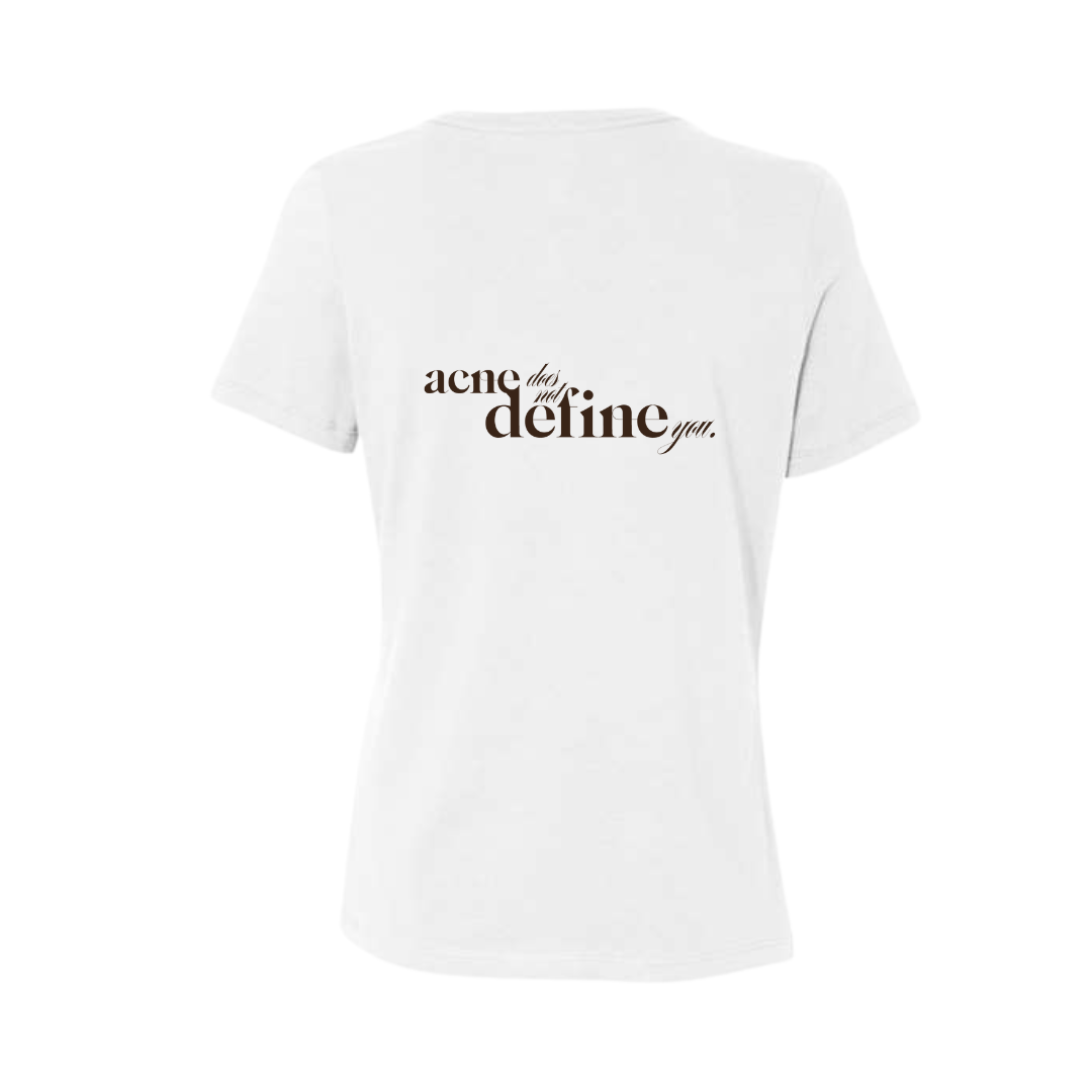 Acne Does Not Define You T-Shirt